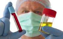 Bladder and blood in urine in women and men: causes, treatment