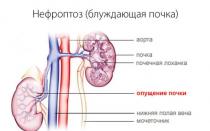 Omission of the right kidney: symptoms, causes and effective treatments for the disease