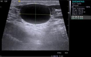 Proper preparation for ultrasound of the kidneys and bladder